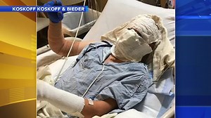 Lawsuits allege danger of cooking spray can explosions