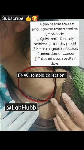 FNAC ||Fine needle aspiration cytology#medical#fnac explained#lump fnac #pathologylab#medicalshorts