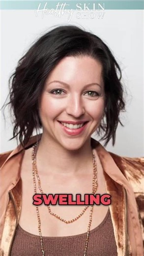 STAPH Skin Infection SYMPTOMS 🧐 #shorts