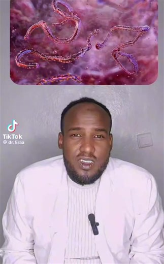 #viral_hemorrhagic_fever | Biyya Koo Oromiyaa