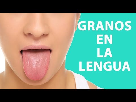 HOW TO CURE PIMPLES ON THE TONGUE?