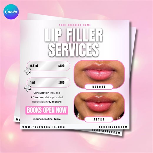 Clinic Lip Filler Flyer Template | Canva Editable (digital Download - Etsy