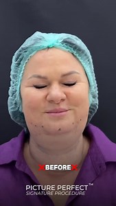 63 reactions · 7 comments |  Say goodbye to double chins & hello to...