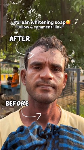Korean whitening soap on Instagram: "Korean whitening soap🥰 Follow & comment”link” COD Available✅✅ . . . #soap #soaps #skincareroutine #skincareproducts #skincare #skin #tanning #tan #manicure #pigmentation #beauty #insta #instagram #instagood #instamood #reels #reel #trending #trendingreels #viral #viralreels"