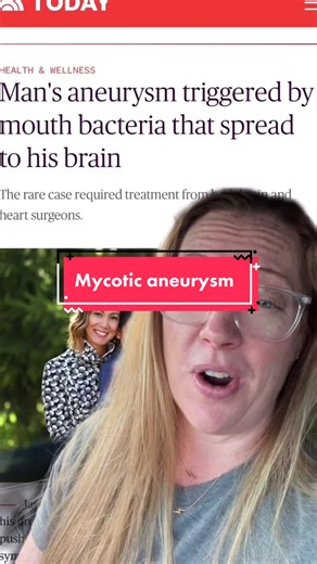 Mycotic aneurysms can develop if you have a bacterial infection in your bloodstream. It can be a life threatening condition. #neurosurgery #mycoticaneurysm #brainsurgery #aneurysm #brainaneurysm