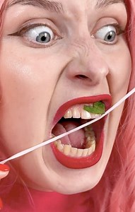 Toothache Level: Dentist Said “Good Luck” 😳 | One More
