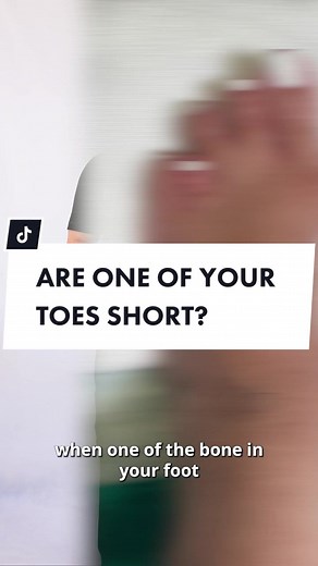 Understanding Short Toes: Insights from a Surgeon