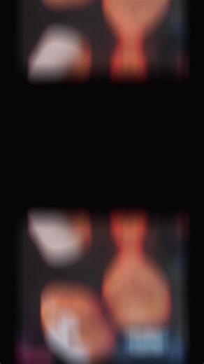 @Helen Renee #fyp #bestfriend