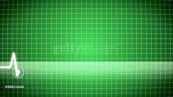 Pulse Trace, Single Line, Equipment, Graph, Line Graph, Heart Shape,...