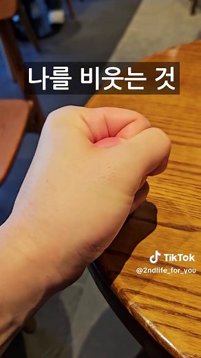 조현병의 초기 증상과 대처법