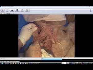 Posterior Triangle of the Neck Dissection: Part 1 (~4 min)