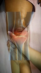 2.2M views · 12K reactions | Knee Joint Pain massage Steps  | Healing Therapy | Facebook