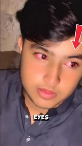 👀 Why Do Our Eyes Turn Red? 😮🔴