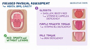 Video: Assessing Nutrition Status - Video Explanation! | Osmosis | Osmosis