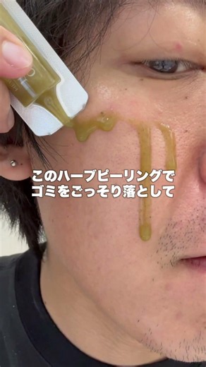 Have you heard about the super-popular herbal peeling treatment lately?! 😳 You're missing out if ...