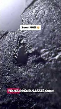 J’ai observé de la peau morte au microscope 🤯