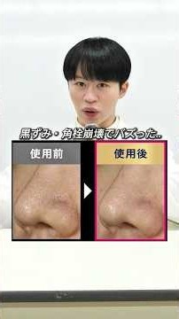 黒ずみ・角栓、1回でここまで変わるのは正直すごい！【保存必須】ただし、とんでもない落とし穴「落ちるから毎日ガッツリ使う」は個人的にはおすすめしません。 #美容 #スキンケア #黒ずみ #角栓 #洗顔