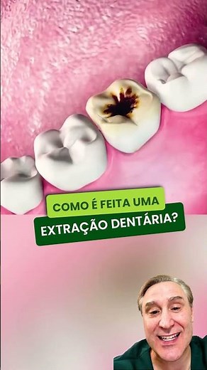 How is a tooth extraction performed?