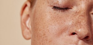 Acne bacteria trigger cells to produce fats, oils and other lipids essential to skin health – new research
