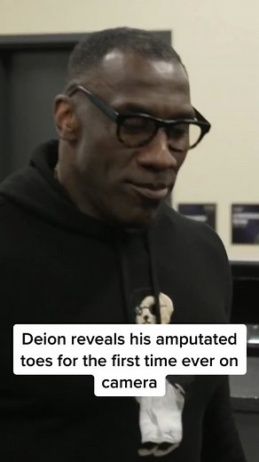 This is my brother 4 real. #deionsanders #amputee #toes #foot