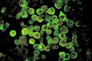 Naegleria Fowleri Amoeba -Characteristics/Symptoms/Treatment/Infection