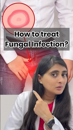 Fungal infection on skin | Ointment for fungal infection | Fungal infection in private parts