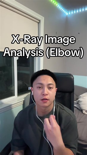 X-Ray Image Analysis of the Elbow