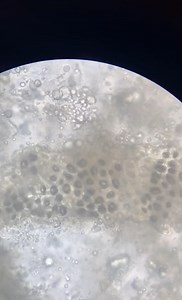 What Happens Under the Microscope Will Amaze You