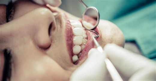 Restauração dental: saiba quando o procedimento é necessário