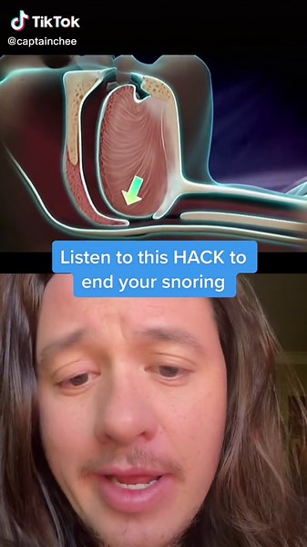 Simple Hack to Stop Snoring | Parody Video feat. @florinvede