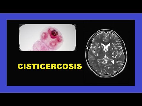 What is Cysticercosis? - Helminthology Course