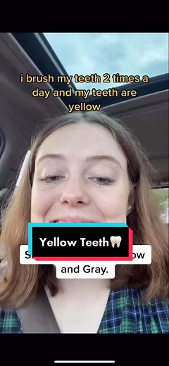 Understanding Teeth Staining: Causes and Solutions