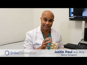 Justin Paul M.D., Ph.D. Discusses Spinal Fracture Surgery