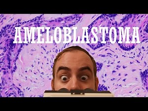 The ULTIMATE Ameloblastoma Review Video