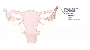 Video: Ovarian cyst - Video Explanation! | Osmosis | Osmosis