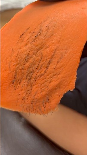 Bikini Wax Before & After | Base Laboratories Ingrown Hair Routine