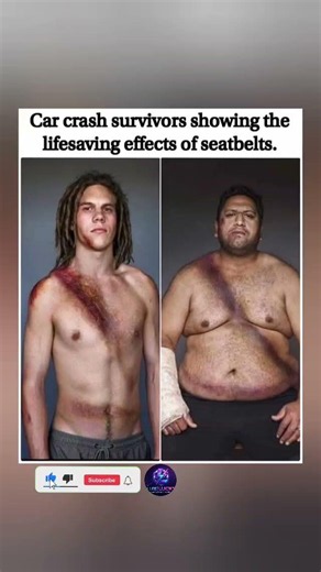 A bruise is better than the alternative. Wear your seatbelt. 🧵❤️ #shorts #trending #viral