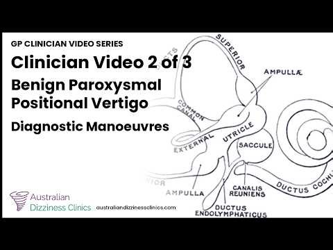 2/3 video — Diagnostic Manoeuvres: Dix-Hallpike and Supine Roll at the Bedside