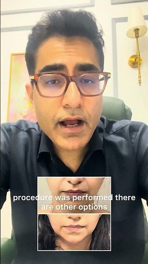 Can you guess how this V-line chin was achieved?