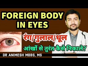 How to remove foreign body from eye at home? 1st aid treatment of foreign body in eyes!Dr Animesh MS
