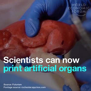 Scientists are changing the face of healthcare by printing 3D organs. Read more: http://wef.ch/2lqohyL | World Economic Forum