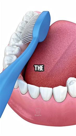 Why You Might Need a Deep Cleaning 🦷 #dentaltips