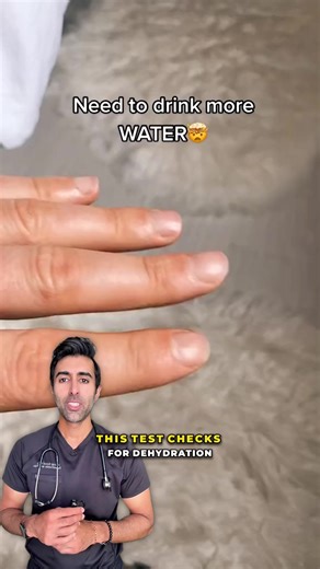 Have you ever tried the skin-pinch test to check for dehydration? It works by measuring how quickly your skin snaps back after being pinched. Slower recoil can mean fluid loss, but age and other factors can affect the results. VC: @remus.bujor Follow @doctorsoood to improve your health IQ and for similar content. #dehydration #skinturgor #hypovolemia #fluidstatus #healthtips #medical | Kunal Sood, MD