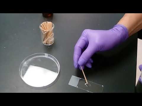 Catalase Test