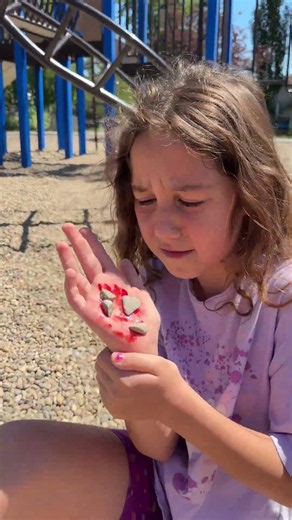 Sierra Got Hurt in the Garden 🌼🤕 | Rhia Helps Her Sister 💛