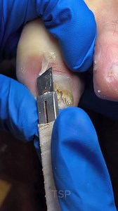 Gentle trim, shiny finish ✨#toenailcare | Pictures of Art