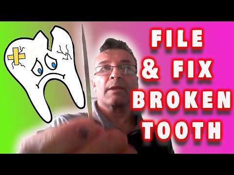 FILE 'N 'FIX BROKEN TOOTH QUICKLY EASILY! Quickly File a Sharp Broken Tooth & NO DENTIST VISIT!