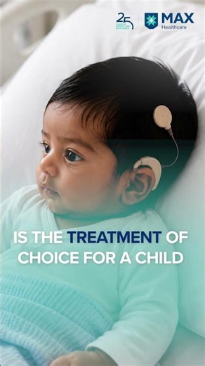 Is 1 Year Too Early for a Cochlear Implant?