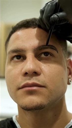 Eyebrow Transplant Process | Step-by-Step Journey to Natural Eyebrows