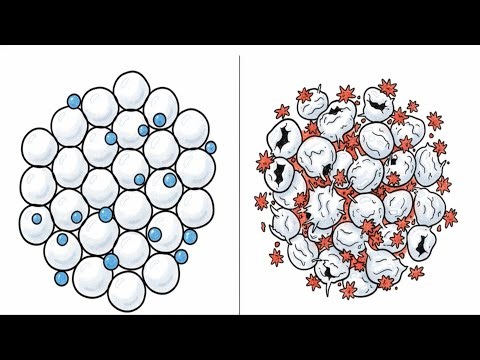 Obesity, Cell Death & Chronic Inflammation: How Fat Tissue Triggers Metabolic Disease